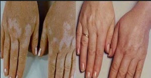 cilt+hastalıkları[1]