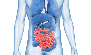 bagirsak-kanserinin-belirtileri-nelerdir[1]