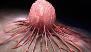 kanseri-huzlandiran-buyuk-tehlike-seker-bizsiziz[1]