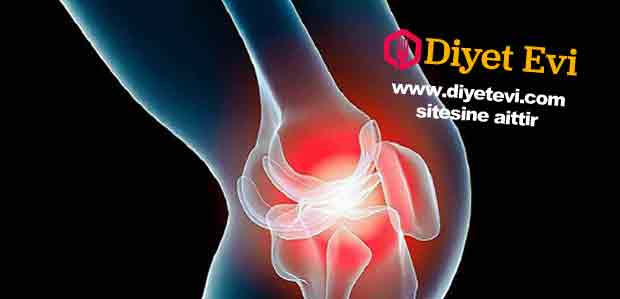eklem-agrisi-41