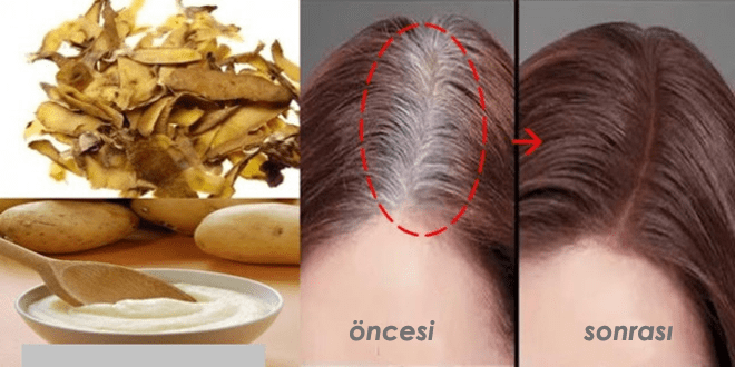 sac-cikarma-sac-bakimi1