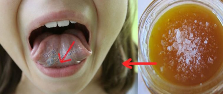 himalaya-tuzu-bal-uyku-dil-altina-757x3201