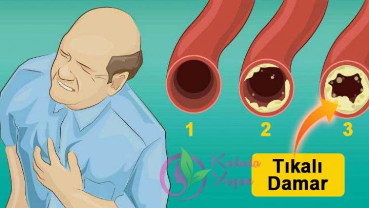 tikali-damarlara-en-iyi-karisim-728x410[1]