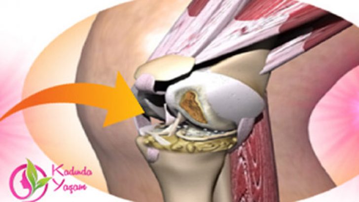 jelatinin-eklemlere-faydalari-nelerdir-1-728x410[1]