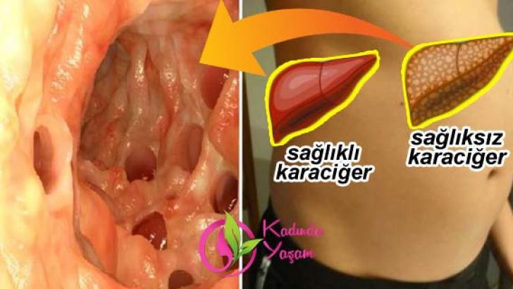 karaciger-genclestirme-728x410[1]