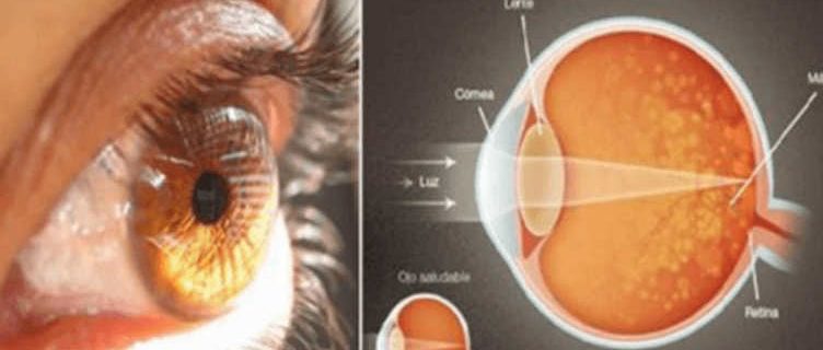 safran-baharat-sari-nokta-goz-icin-752x320[1]