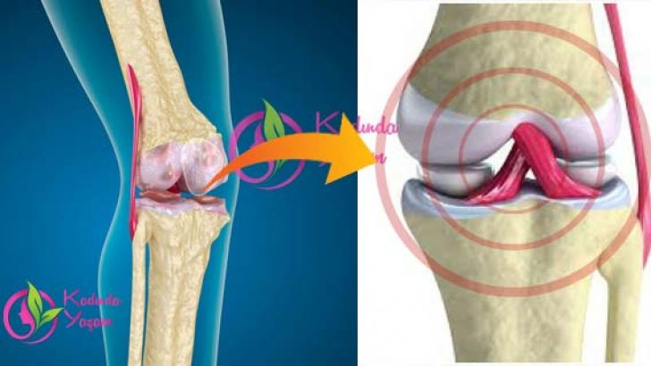 limon-kabuguylla-eklem-agrisi-tedavisi-728x410[1]