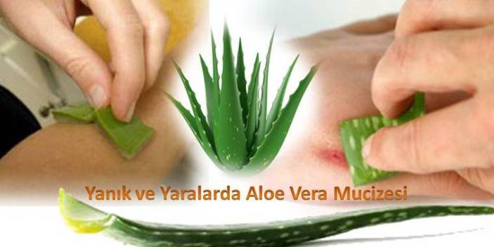 Yanık-ve-Yaralarda-Aloe-Vera-mucizesi[1]