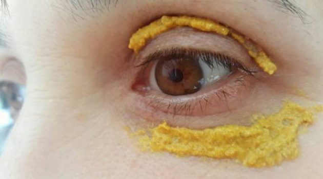 zerdeçal-siyah-göz-halkalarına-iyi-geliyor