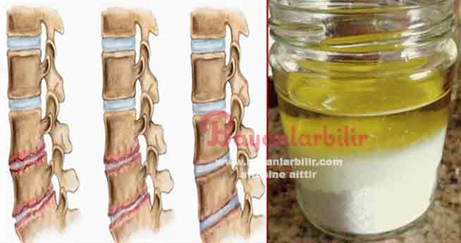 Eklem-ağrısına-zeytinyağı-ve-tuz-tedavisi[1]
