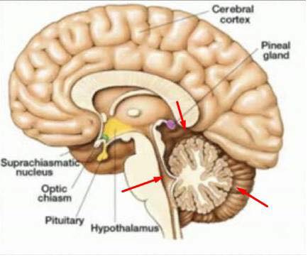 21752115_1857388834291293_7123390988887694502_n[1]