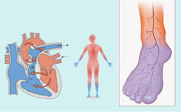 El-ve-Ayaklarınız-Sürekli-Üşüyorsa-Doğal-Tedavi-Yöntemi[1]